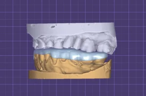 положение челюстей в CAD-системе