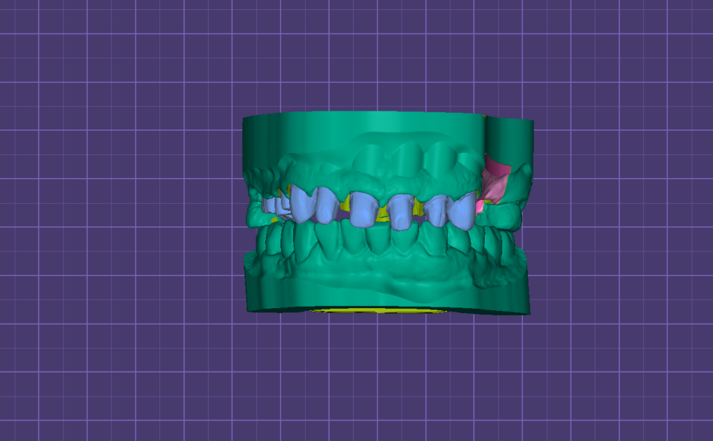 Цифровой протокол CAD/CAM